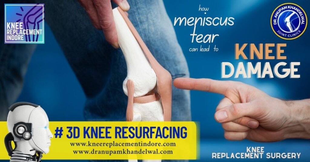 menisus tear knee damage - dr anupam khandelwal